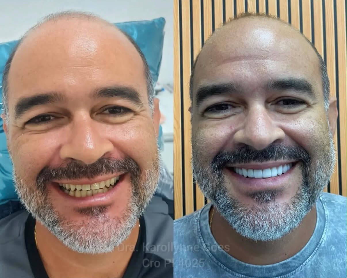 Reabilitação oral estética